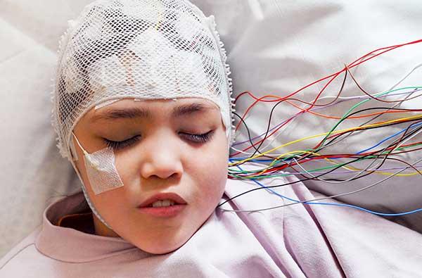 Things to Know and Expect if Your Child has Epilepsy