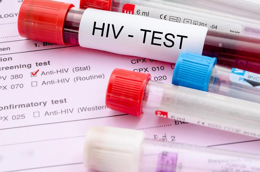 HIV and Emergency Testing