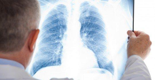 Warning Signs of Pneumonia