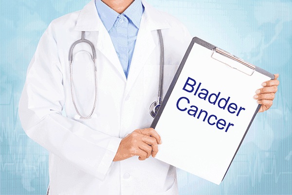 Bladder Cancer 101 – Causes, Symptoms of Bladder Cancer
