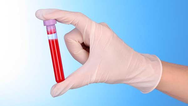 Using Blood Tests for Early Cancer Diagnosis