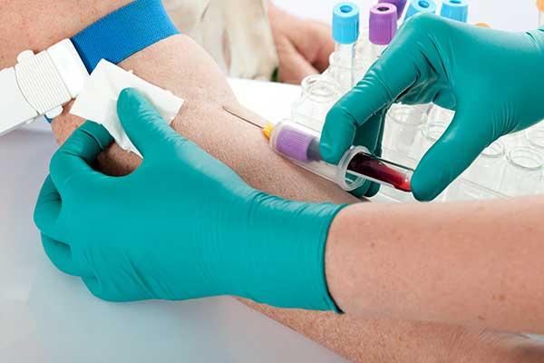 10 Blood Tests to Take Today for Excellent Health