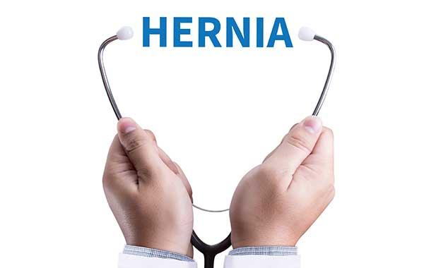 Understanding Hernias