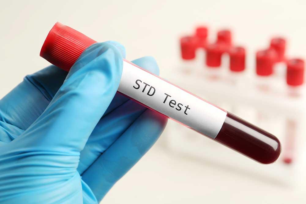Understanding the Different Types of STDs