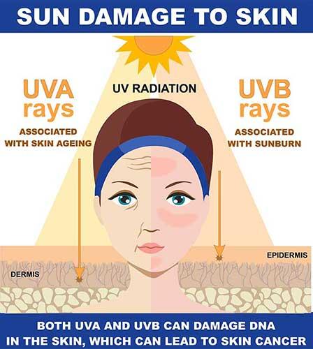 Dangers of UV (ultraviolet) Radiation